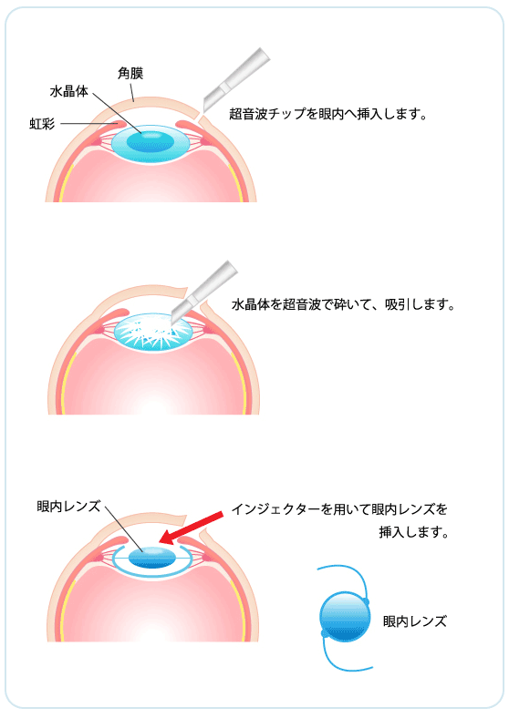 流れ