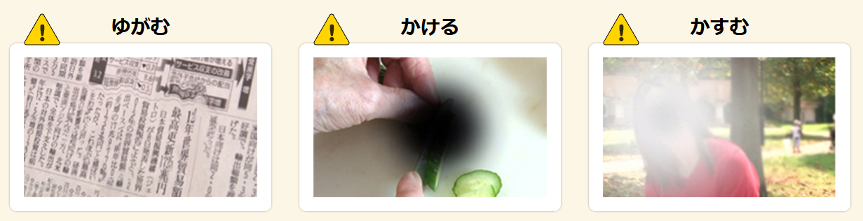 黄斑浮腫の見え方