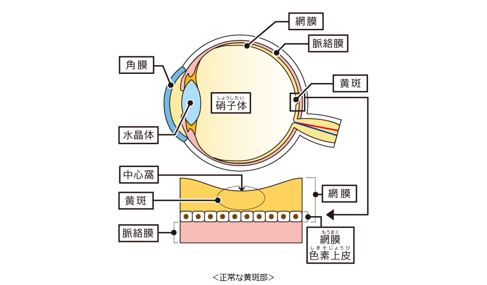 黄斑