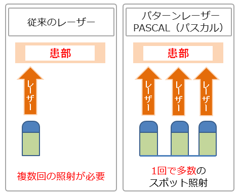 治療時間の短縮